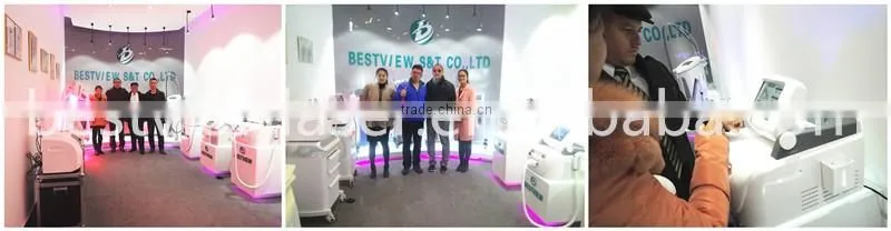 Ultrasonic cavitation treatments cavitation slimming treatment BM-606