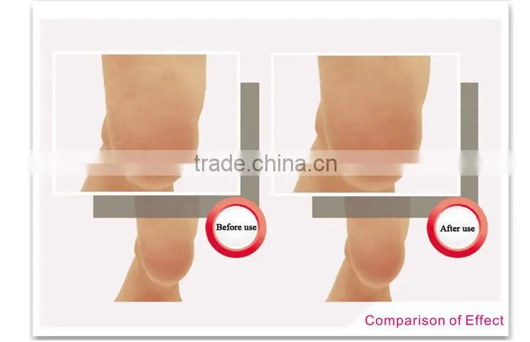 Callus Remover