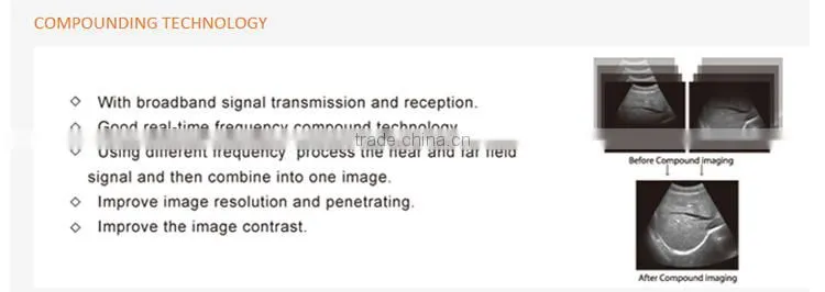 MCB-8500 High definition Black and White Ultrasound Machine best price for portable echographe doppler mindray