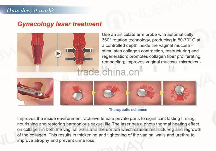 2015 Lowest Distributor price: laser co2 fraccionado for Acne Scars Treatment , Burn Debridement