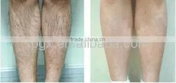 Manufacture Supplied Portable Hair Removal IPL Machine
