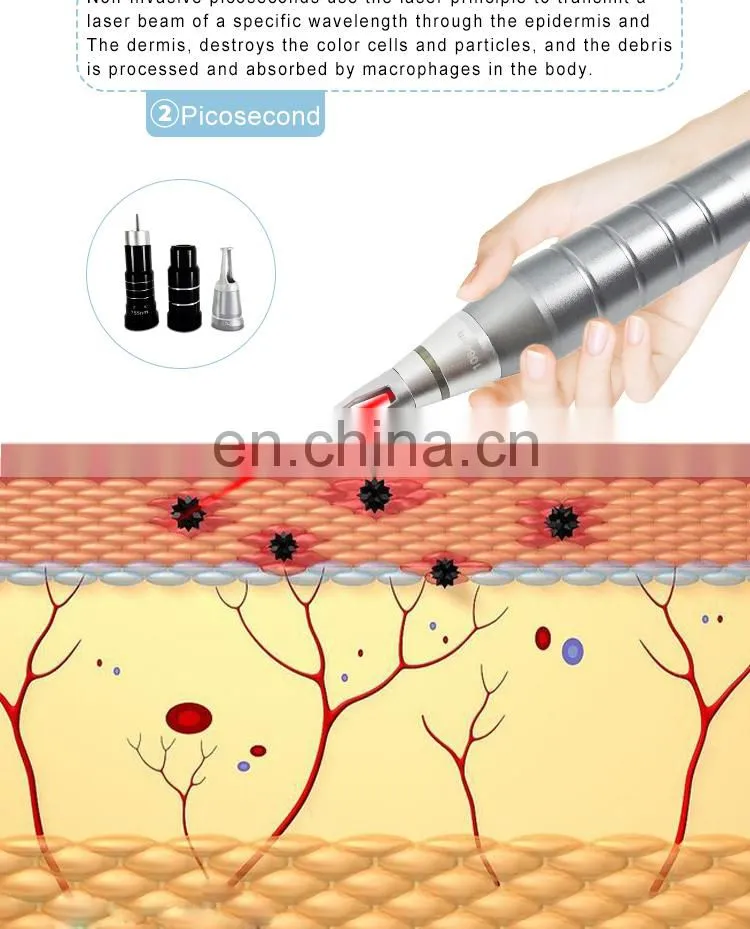 808 Diode Laser Hair Removal Device 755nm Picosecond Laser Skin Rejuvenation Tattoo Removal Black face doll Beauty Equipment