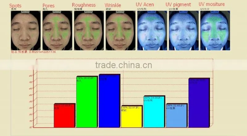 Magic Mirror-Skin Analysis System AYJ-J009