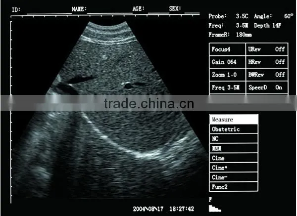 Sonostar good quality handheld portable vet ultrasound scanner pig veterinary ultrasound V6