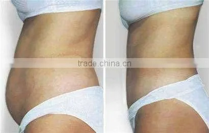 Nouveau!! ultra sound radio frequency slimming machine F006