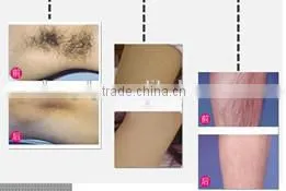 810 DIODE LASER HAIR REMOVAL