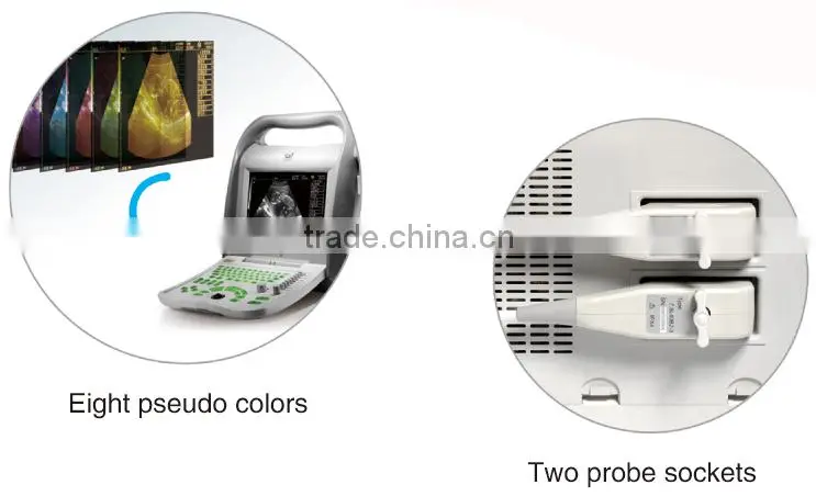 FN550V HOT selling full digital B model ultrasound veterinary portable