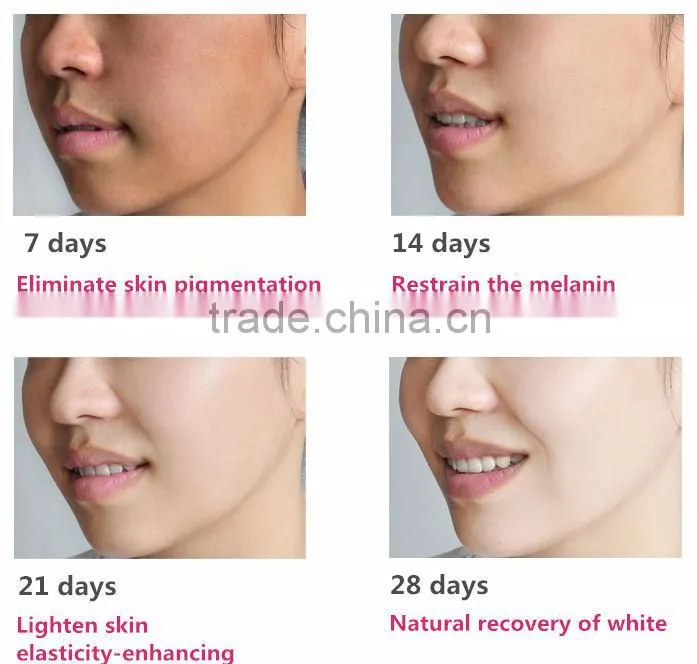 New arrival speckle removal face formula cream for whitening