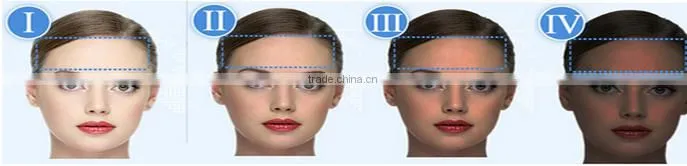 Hottest newest double pulse 808 diode laser portable