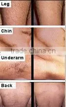 Salon equipment laser hair removal for sale