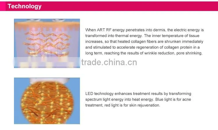 Home use RF wrinkle treatment/rf skin rejuvenation for sale