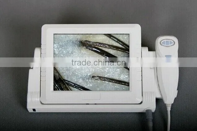 AYJ-J015(CE) boxy lcd monitor skin scope analyzer from china
