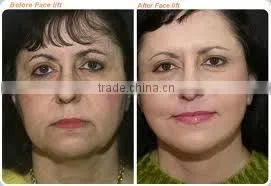 Vacuum cavitation system supersonic multifunctional beauty equipment for body shaping