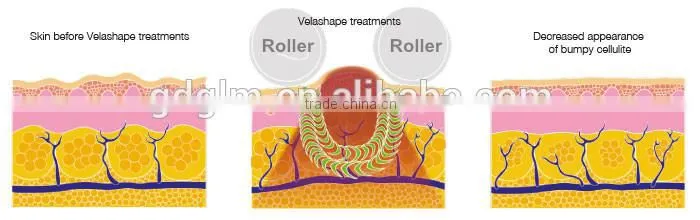 Cavitation+Vacuum+RF+Infrared light+Roller system beauty machine