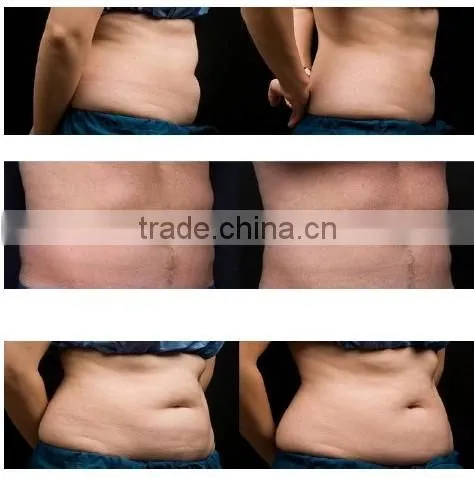 Home use Cavitation fat burning RF laser slimming machine