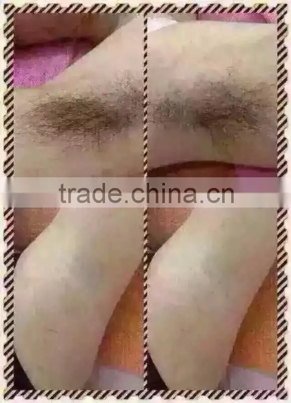 acne removal beauty device elight beauty beauty salon devices
