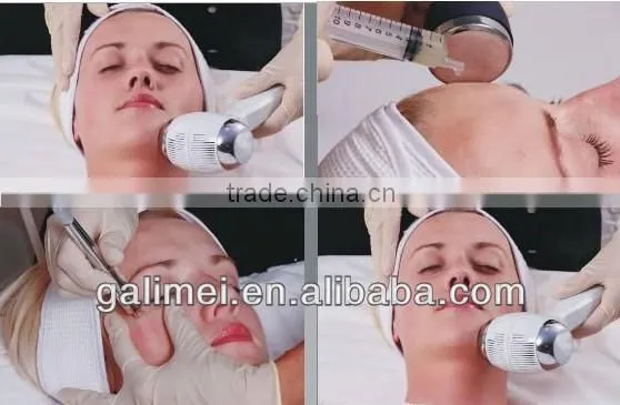 Best 3 in 1 ultrasonic microdermabrasion skin peeling machine