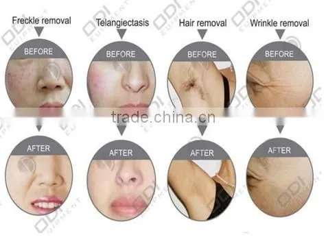 Upgrade IPL Hair Removal machine touch screen of a900