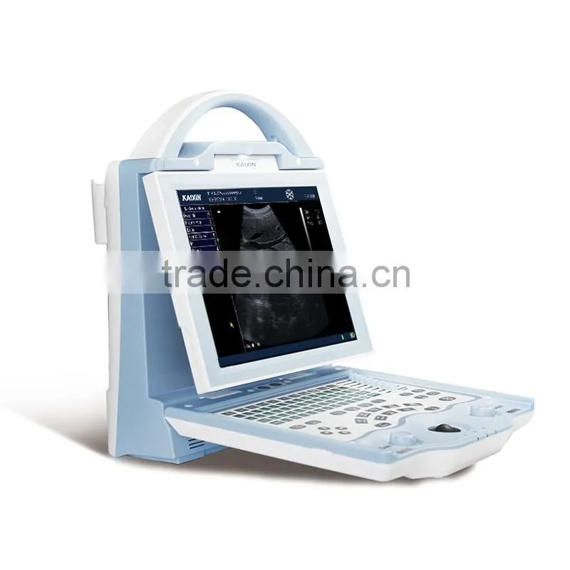 hospital Equipment laptop ultrasound machine/portable ultrasound scanner KX5600