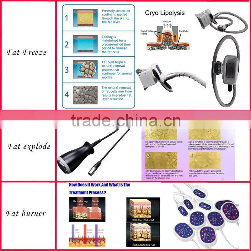 cryolipolysis Vacuum/Lipo Laser/Radio Frequency RF/Cavitation Slimming Beauty Machine