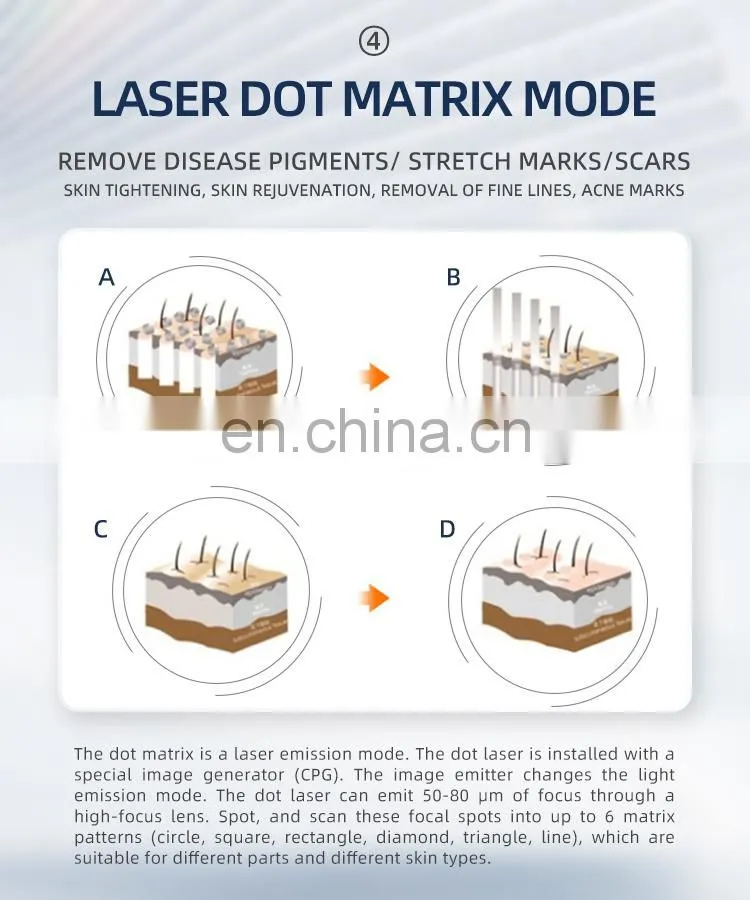 Medical Equipment CO2 Fractional Laser Vaginal Tightening Skin Resurfacing Acne Scar Removal Machine
