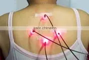 Low power fiber diode laser therapy laser for Tinnitus, Rhinitis