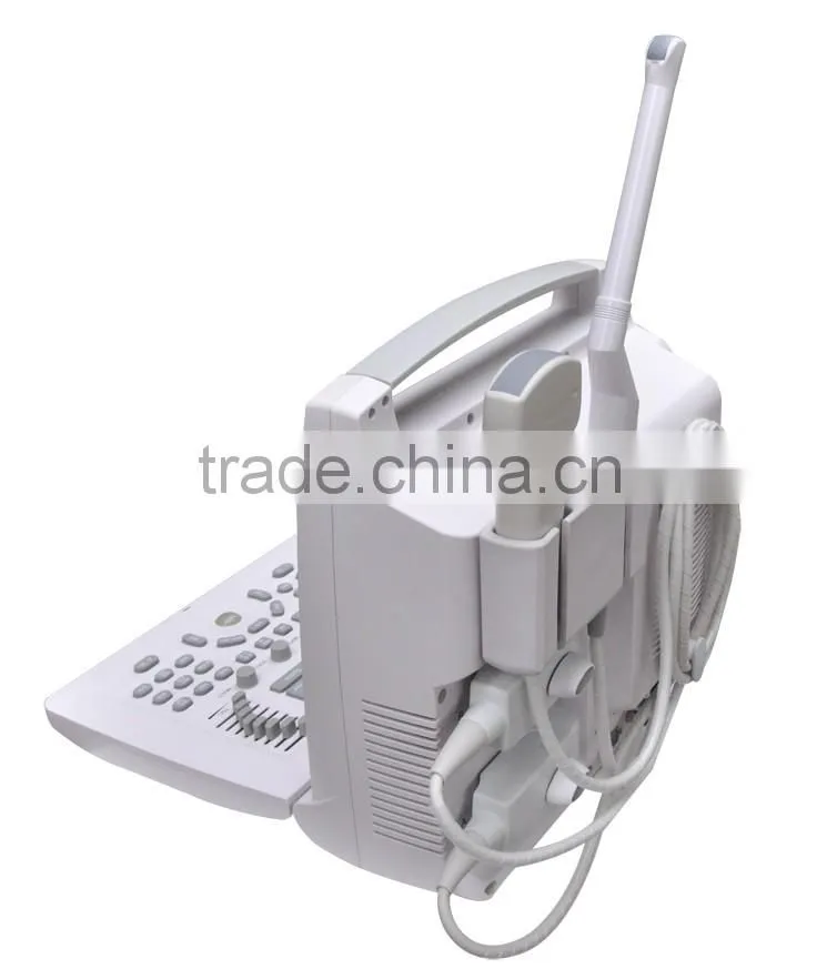 imported 12 " LCD Handled USB B Ultrasound machine in white color