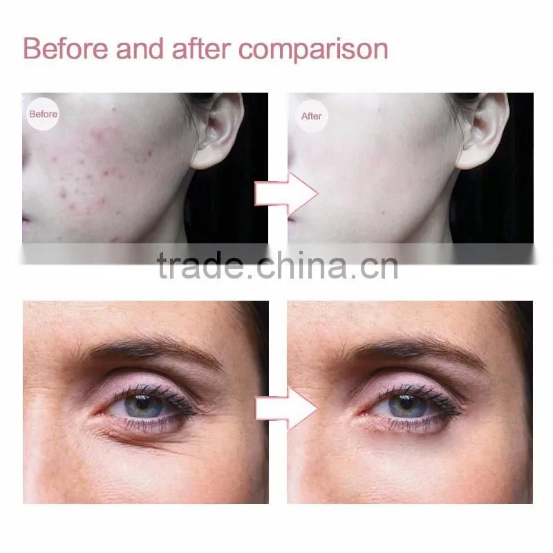 Led light therapy beauty face Led facial mask beauty face massager