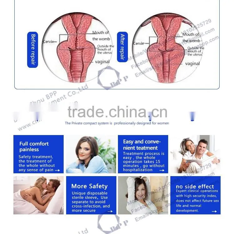 BPP wholesale hifu vaginal tightening machine
