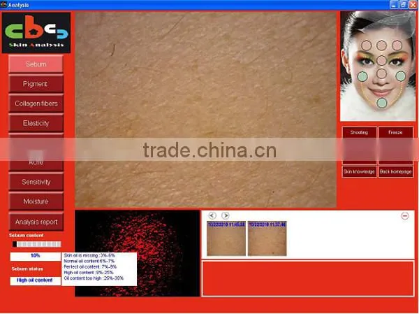 Toppest FCC approved Patented Taiwan CBS facial skin analyzer