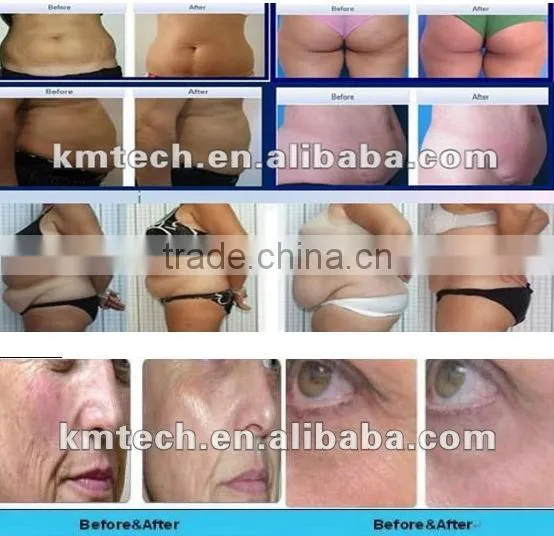 CE certification cavitation rf body slimming for salon beauty machine