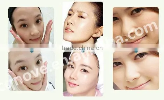 2016 Magic beauty instrument