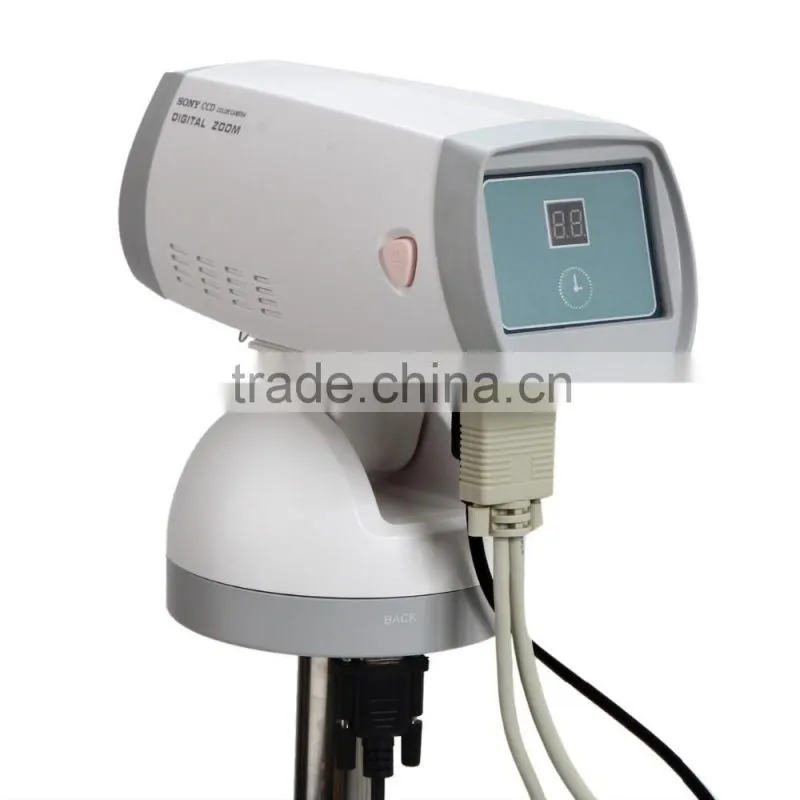 FY-9100A Excellent Portable Type Digital Electronic Colposcope