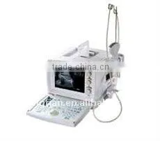 Full Digital Trolley Ultrasound Scanner/ultrsound