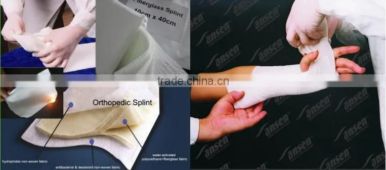 moldable orthopedic cast plint Leg splint