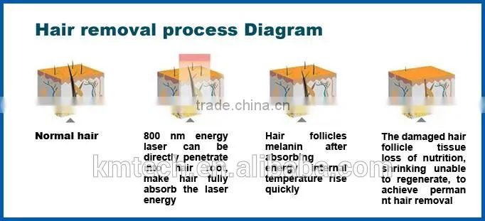 808 nm Diode Laser Epilation Electric Beauty Machines by Sapphire Contact Cooling