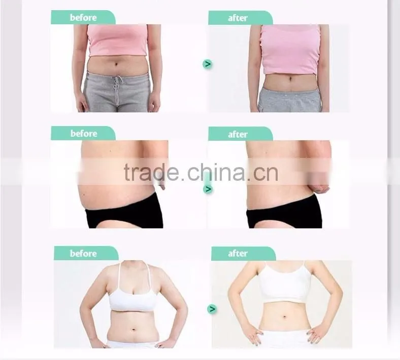CE Certification portable Laser+Cavitation+RF+Vacuum cavitation slimming machine