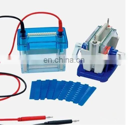 Assessment serum protein electrophoresis in clinical diagnosis