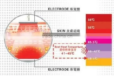 5mhz radiofrequency rf facelift machine home use