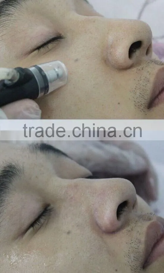 7 in 1 facial Exfoliators hydra microdermabrasion skin cleasing brush machine