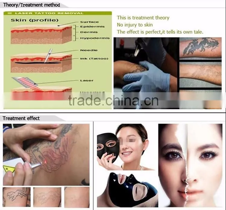 laser tattoo removal beauty equipment with cheap price