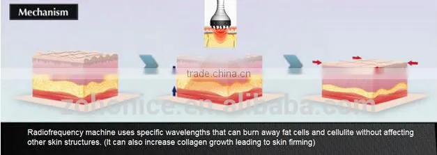 BD06C super RF vacuum with cryo Fat freezing sliming machine