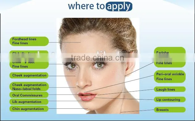 Cosmetic Grade hyaluronic acid cosmetic injections