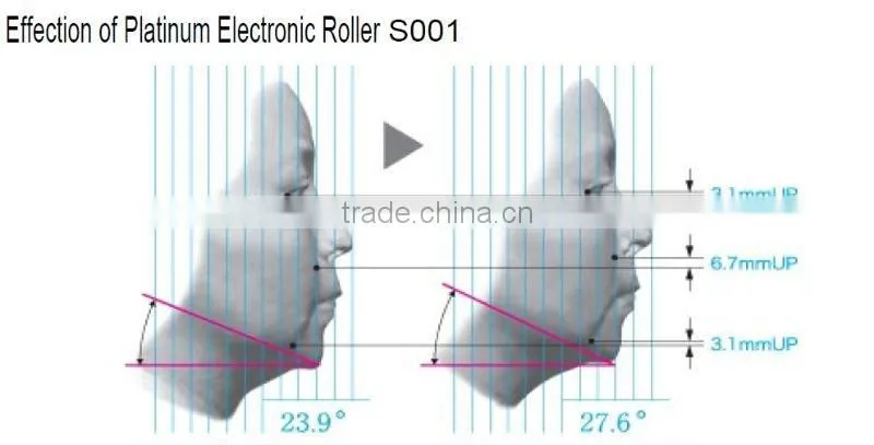 S001---Skin Tighten Roller For Erase wrikles,Lift up jaws