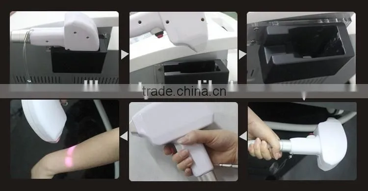 Hotsale 808nm diode laser hair removal machine