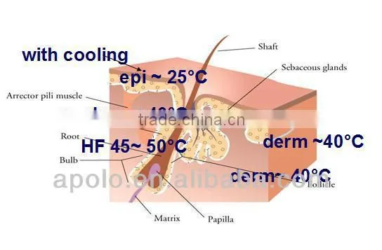 medical 808nm diode laser hair removal machine HS 811 laser hair removal device painless by shanghai apolo medical technology