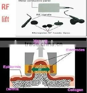 VY-F3 Portable radio frequency machine home use for sale