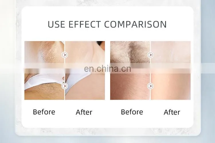 Triple 3 wavelength diode laser diodo lazer ice platinum hair removal 808nm depilacion titanium machine 2021 price