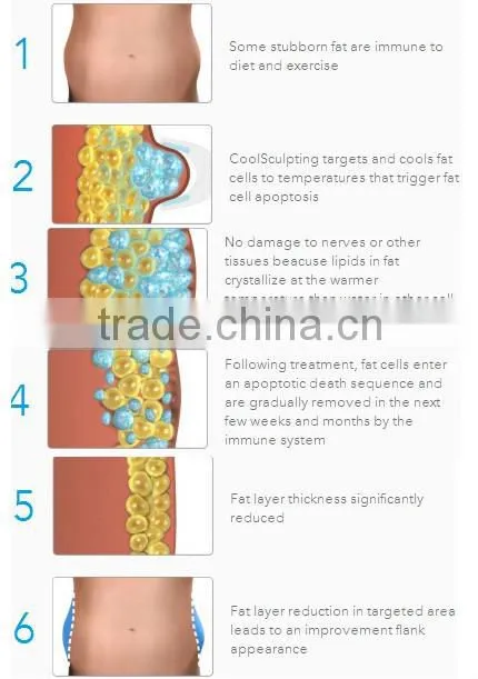 China 5 handles body slimming massage beauty equipment for sale
