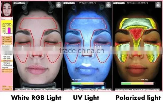 3D face camera equipment / professional skin analyzer for beauty salon